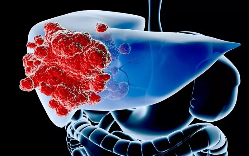 Cây xạ đen giúp ức chế tế bào ung thư gan