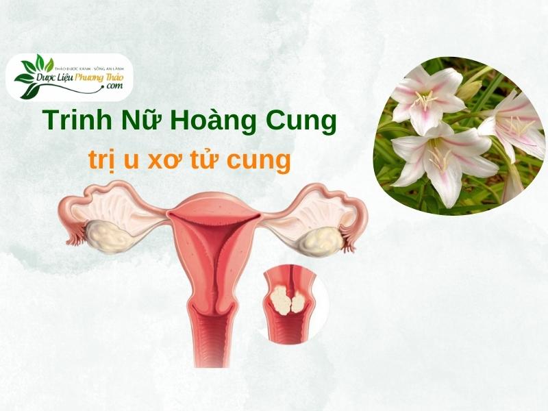 Trinh Nữ Hoàng Cung trị u xơ tử cung