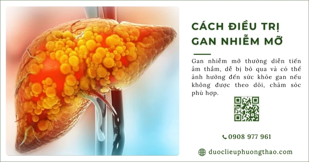 Cách điều trị gan nhiễm mỡ cần chú ý những gì?