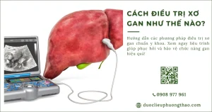 Cách điều trị xơ gan phụ thuộc vào những yếu tố nào?