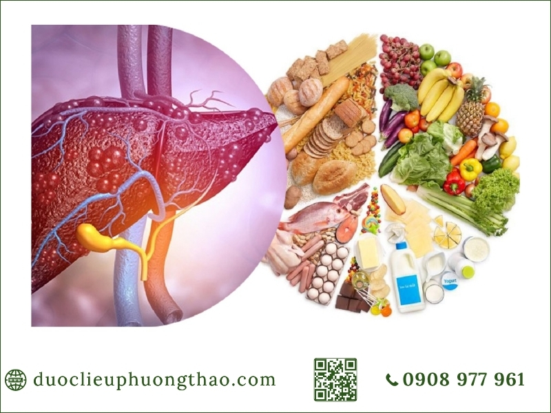 Triệu chứng gan nhiễm mỡ phòng tránh gan nhiễm mỡ