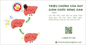 Triệu chứng suy giảm chức năng gan: Dấu hiệu nhận biết và khi nào cần đi khám?
