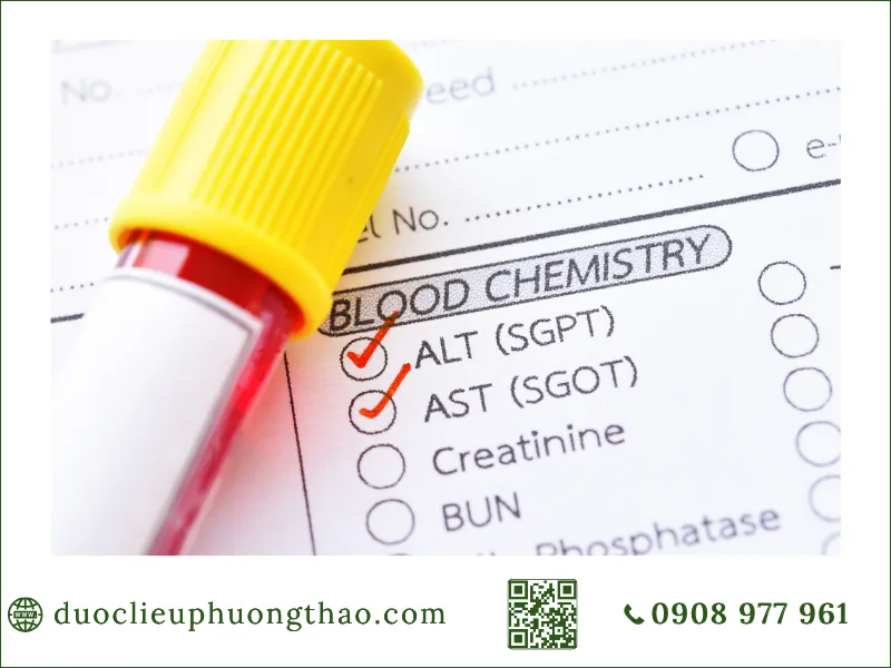 Men gan cao là gì? Nguyên nhân, triệu chứng và Cách phòng tránh như thế nào? Phiếu xét nghiệm máu kiểm tra chỉ số men gan ALT SGPT và AST SGOT
