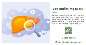 Gan nhiễm mỡ là gì? Vì sao chất béo có thể tích tụ trong gan?
