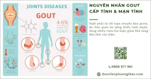 Nguyên nhân gout cấp tính và mạn tính? Vì sao axit uric tăng cao?