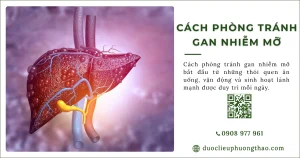 Cách phòng tránh gan nhiễm mỡ nên thực hiện ra sao?