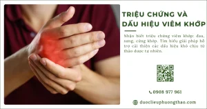 Triệu chứng viêm khớp: Các dấu hiệu nhận biết và khi nào cần đi khám