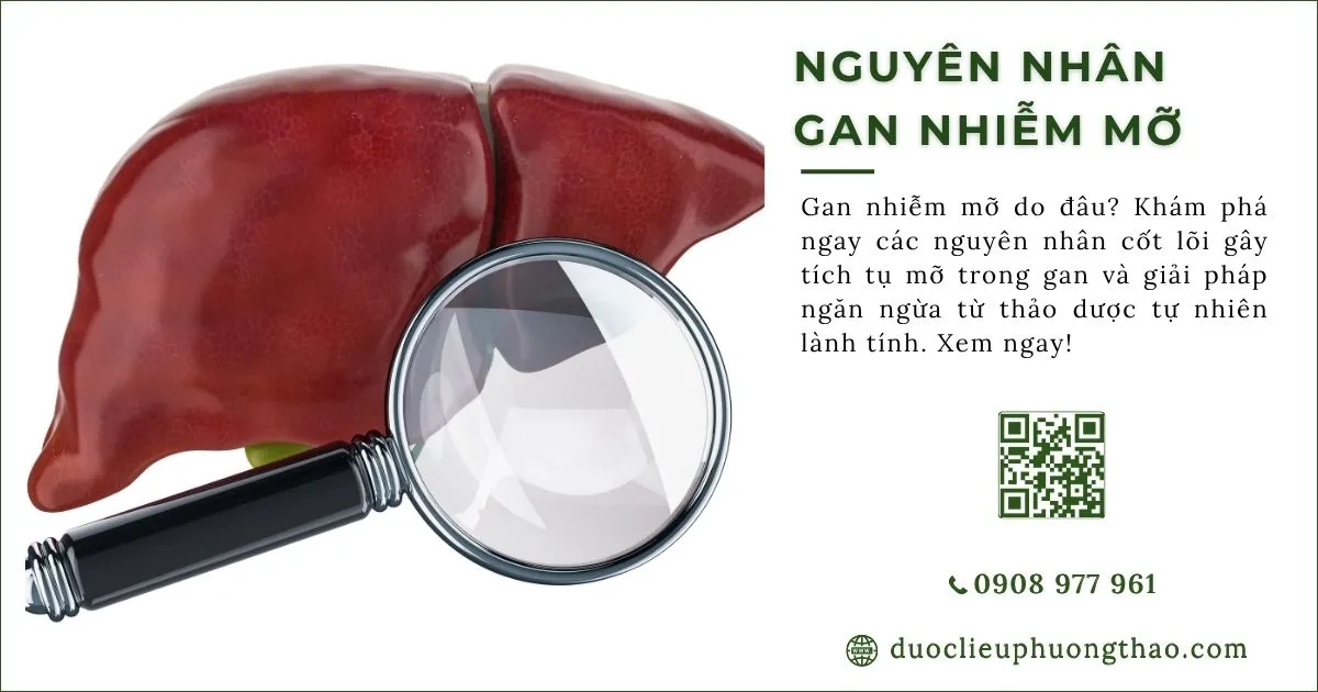 nguyên nhân gan nhiễm mỡ