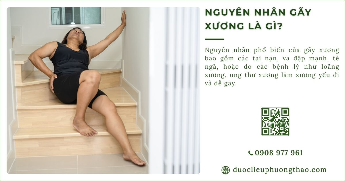 nguyên nhân gãy xương