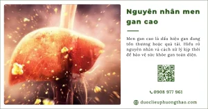 Nguyên nhân men gan cao là do đâu? Những yếu tố thường gặp và cách nhận biết