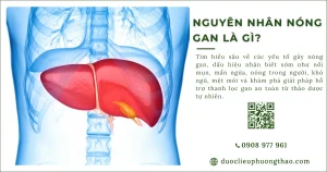 Nguyên nhân nóng gan có thể đến từ đâu?