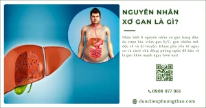 Nguyên nhân xơ gan là gì? Vì sao tổn thương kéo dài lại dẫn đến xơ hóa gan?