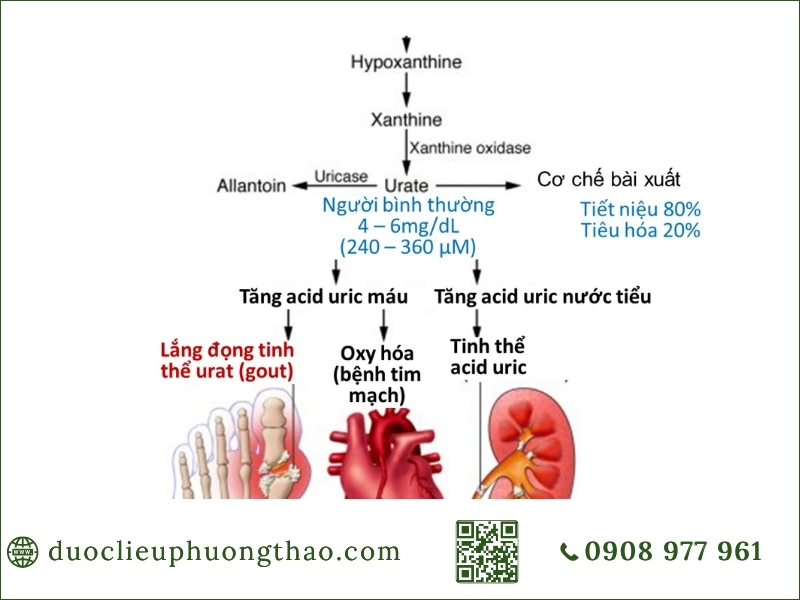 Sơ đồ cơ chế chuyển hóa và bài xuất giải thích nguyên nhân tăng axit uric máu