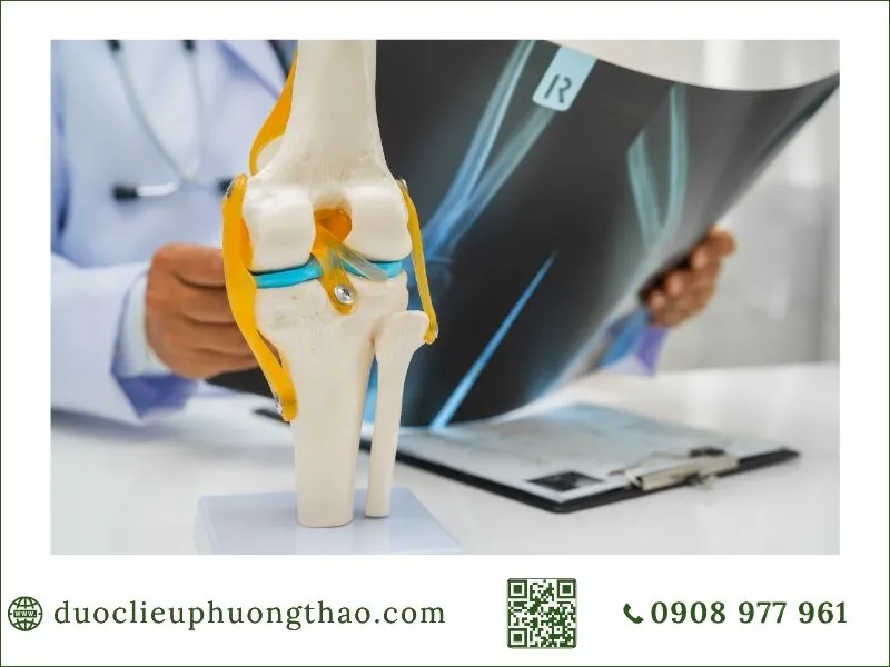 Nguyên nhân đau nhức xương khớp là gì? Các nguyên nhân thường gặp và lưu ý cách phòng tránh đau nhức xương khớp là gì