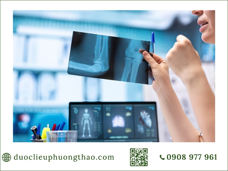 Bác sĩ xem phim X-quang chẩn đoán đau nhức xương khớp