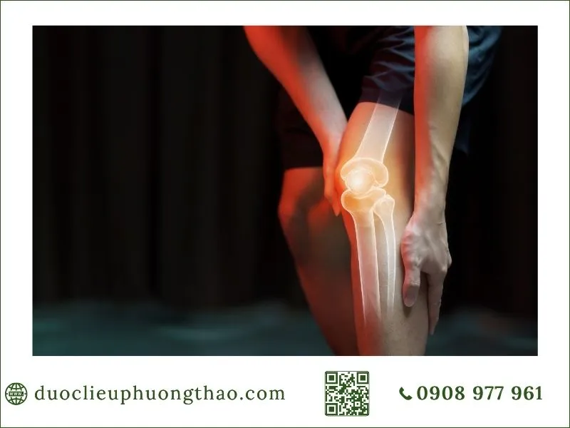 Nguyên nhân đau nhức xương khớp là gì? Các nguyên nhân thường gặp và lưu ý đau nhức xương khớp là gì