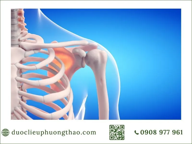 Triệu chứng đau nhức xương khớp là gì? Những dấu hiệu nào thường gặp? nguyên nhân đau nhức xương khớp là gì