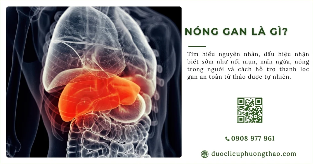 Nóng gan là gì?  Có những nguyên nhân, triệu chứng và cách phòng tránh nào?