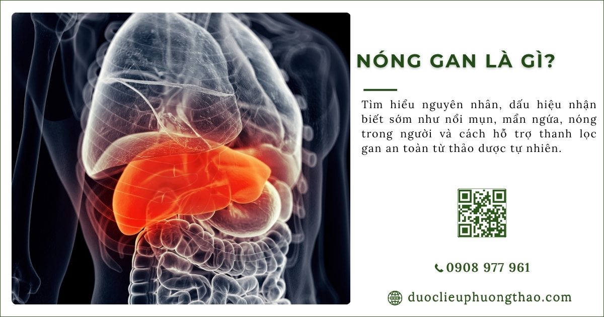 nóng gan là gì