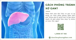 Có những cách phòng tránh xơ gan nào?
