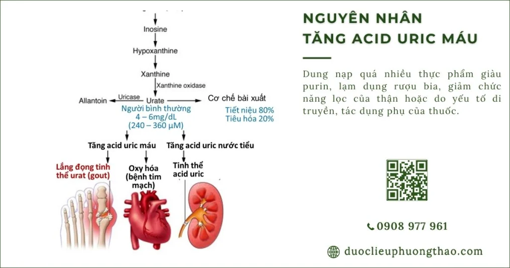 Nguyên nhân tăng axit uric máu là gì? Vì sao chỉ số axit uric tăng cao?