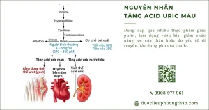 Nguyên nhân tăng axit uric máu là gì? Vì sao chỉ số axit uric tăng cao?