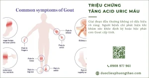 Triệu chứng tăng axit uric máu: Dấu hiệu nào cần lưu ý?