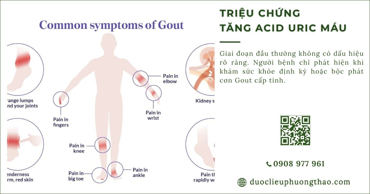 triệu chứng tăng axit uric máu