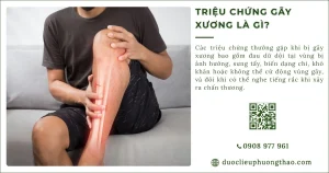 Triệu chứng gãy xương là gì? Những dấu hiệu nhận biết sớm