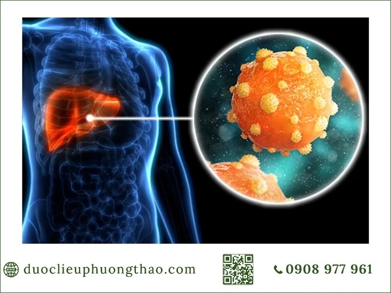 Triệu chứng viêm gan B triệu chứng viêm gan B