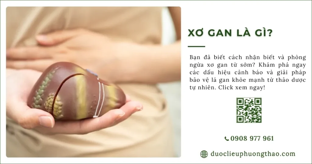 Xơ gan là gì? Có những nguyên nhân, triệu chứng và cách phòng tránh nào?