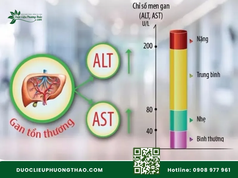 Biểu đồ minh họa các mức độ tăng chỉ số men gan AST và ALT