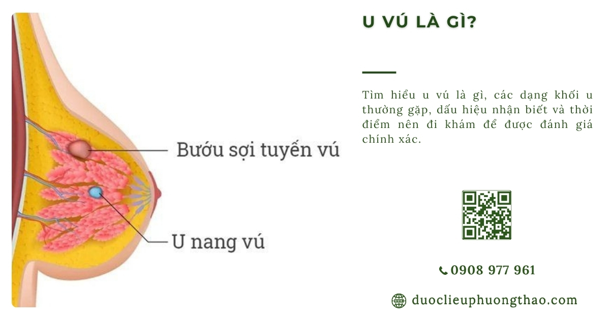 u vú là gì