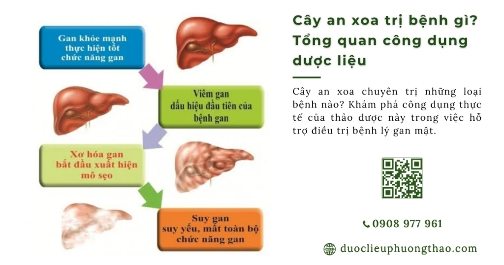 Cây an xoa trị về bệnh gì? 3 công dụng thật sự người bệnh gan cần nắm rõ