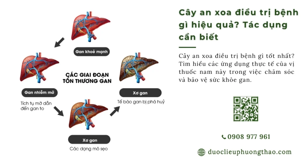 Cây an xoa điều trị bệnh gì? Có dứt điểm được bệnh gan không?