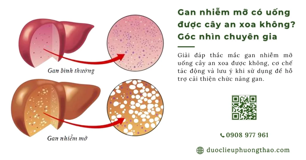 Gan nhiễm mỡ có uống được cây an xoa không? 3 lưu ý tuyệt đối không bỏ qua