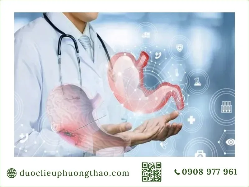 Ung thư dạ dày là gì? Nguyên nhân, dấu hiệu và hướng xử trí phù hợp Bác sĩ chỉ vị trí khối u dạ dày trên mô hình giải phẫu