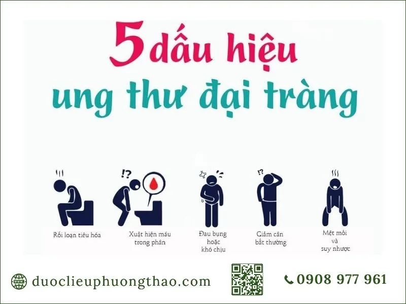 5 dấu hiệu ung thư đại tràng cảnh báo người bệnh cần đi khám