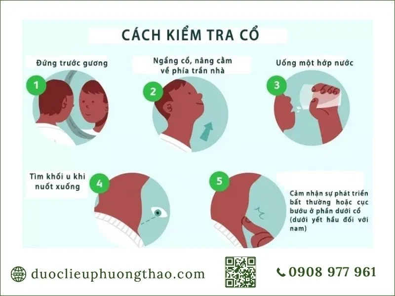 Hướng dẫn 5 bước tự kiểm tra vùng cổ phát hiện u nhân tuyến giáp là gì