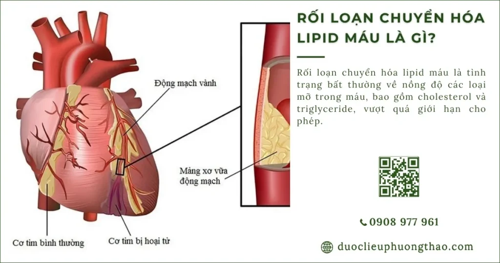 Rối loạn chuyển hóa lipid máu là gì? Nguyên nhân, triệu chứng và cách kiểm soát hiệu quả