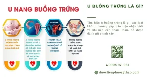 U buồng trứng là gì? Dấu hiệu, nguyên nhân và hướng xử trí phù hợp