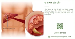 U gan là gì? Phân loại, dấu hiệu, nguyên nhân và cách điều trị