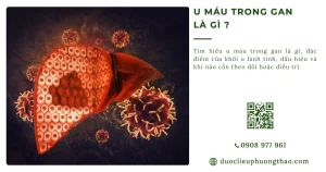 U máu trong gan là gì? Nguyên nhân, triệu chứng và cách xử trí an toàn