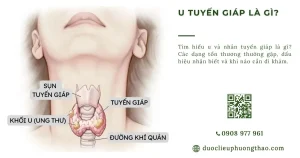 U nhân tuyến giáp là gì và có phải ung thư không?