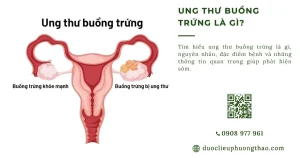 Ung thư buồng trứng là gì? Nguyên nhân, dấu hiệu và cách điều trị
