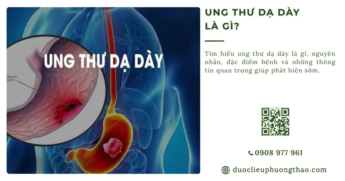 ung thư dạ dày là gì