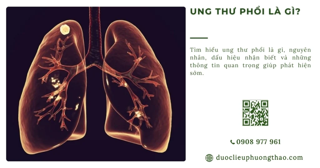 Ung thư phổi là gì? Giải thích dễ hiểu về nguyên nhân, dấu hiệu và cách xử trí