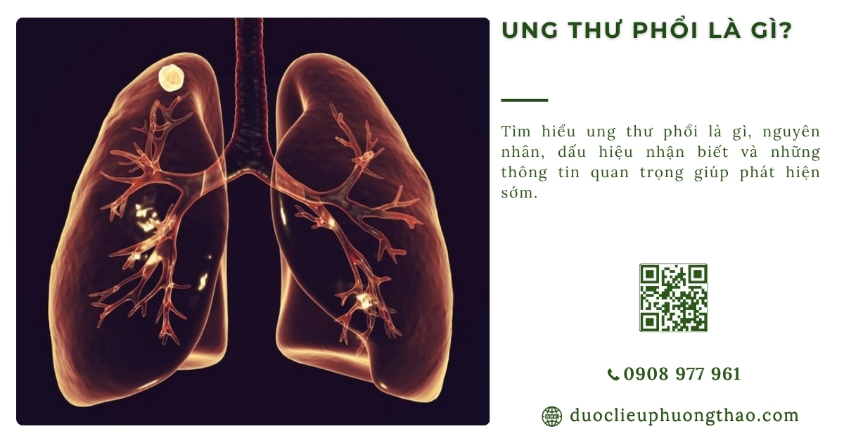 ung thư phổi là gì
