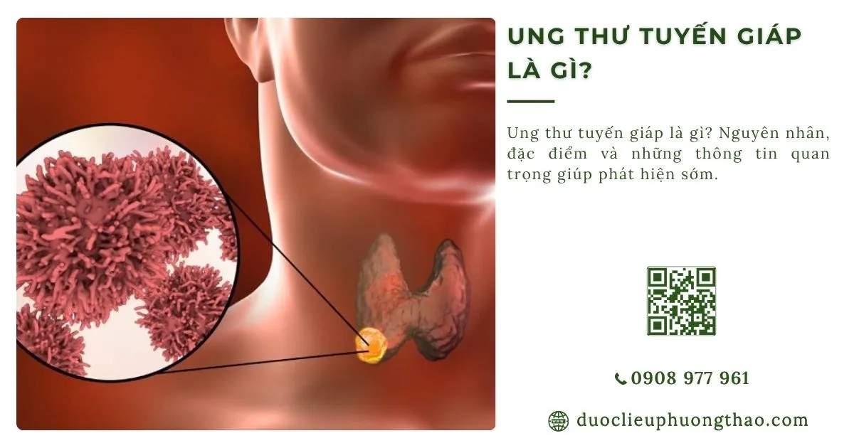 ung thư tuyến giáp là gì