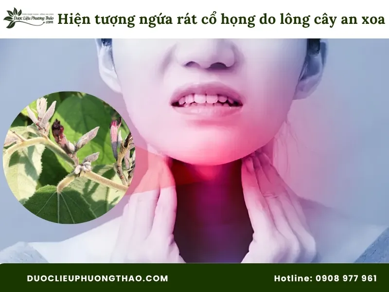 Hiện tượng ngứa rát cổ họng do lông tơ cây an xoa